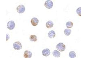 Immunocytochemistry of DDX3 in HepG2 cells with AP30283PU-N DDX3 antibody at 10 μg/ml.