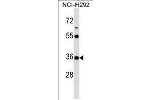 Western blot analysis in NCI-H292 cell line lysates (35ug/lane). (KCTD17 anticorps  (AA 107-136))