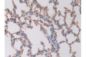 Detection of CA2 in Rat Lung Tissue using Polyclonal Antibody to Carbonic Anhydrase II (CA2)