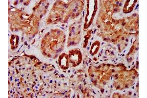 IHC image of ABIN7158882 diluted at 1:400 and staining in paraffin-embedded human kidney tissue performed on a Leica BondTM system.