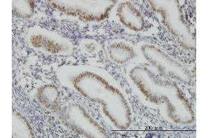 Immunoperoxidase of monoclonal antibody to SP1 on formalin-fixed paraffin-embedded human endometrium.