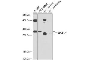 Western blot analysis of extracts of various cell lines, using SLC31 antibody (0109) at 1:1000 dilution.