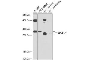 Western blot analysis of extracts of various cell lines, using SLC31 antibody (0109) at 1:1000 dilution. (SLC31A1 anticorps  (AA 1-60))