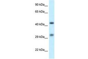 anti-Scavenger Receptor Class B, Member 2 (SCARB2) (AA 25-74) antibody