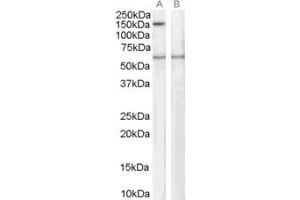 ABIN185175 staining (1µg/ml) of Human EBV-immortilized lymphoblastoid lysate (RIPA buffer, 35µg total protein per lane).