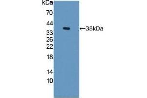 Detection of Recombinant S17aH, Rat using Polyclonal Antibody to Cytochrome P450 17A1 (CYP17A1)