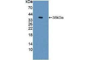 Detection of Recombinant S17aH, Rat using Polyclonal Antibody to Cytochrome P450 17A1 (CYP17A1) (CYP17A1 anticorps  (AA 201-507))