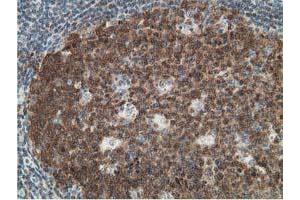 Image no. 1 for anti-Deoxycytidine Kinase (DCK) antibody (ABIN1497775)