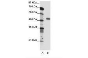 Image no. 1 for anti-Nuclear Transcription Factor Y, gamma (NFYC) (C-Term) antibody (ABIN6736095) (NFYC anticorps  (C-Term))