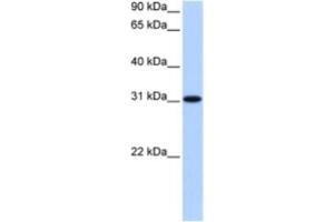 Western Blotting (WB) image for anti-Trinucleotide Repeat Containing 18 (TNRC18) antibody (ABIN2463465) (TNRC18 anticorps)