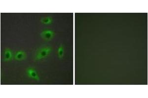 Immunofluorescence analysis of HuvEc cells, using BAX Antibody. (BAX anticorps  (AA 41-90))