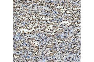 IHC analysis of hnRNP L/HNRNPL using anti-hnRNP L/HNRNPL antibody (ABIN7600130). (HNRNPL anticorps  (AA 152-569))