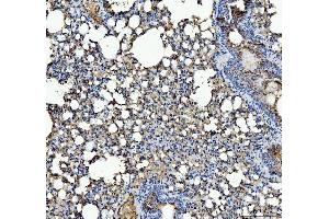 IHC analysis of IL1RA/Il1rn using anti-IL1RA/Il1rn antibody (ABIN7601415).