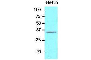 Western Blotting (WB) image for anti-BRCA1/BRCA2-Containing Complex, Subunit 3 (BRCC3) (AA 1-316), (N-Term) antibody (ABIN400864)