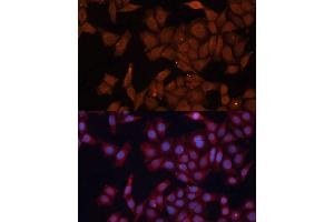 Immunofluorescence analysis of HeLa cells using HMGCS1 Polyclonal Antibody (ABIN1680300, ABIN5664518, ABIN5664520 and ABIN6220423) at dilution of 1:100 (40x lens). (HMGCS1 anticorps  (AA 241-520))