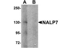 Western blot analysis of NALP7 in human brain tissue lysate with NALP7 antibody at 1 μg/ml in (A) the absence and (B) the presence of blocking peptide. (NLRP7 anticorps  (N-Term))