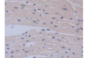 Detection of IL12A in Mouse Heart Tissue using Polyclonal Antibody to Interleukin 12A (IL12A)