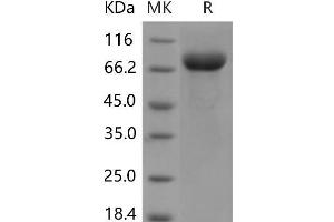 Western Blotting (WB) image for Leukocyte Immunoglobulin-Like Receptor B3 (LILRB3) protein (His tag) (ABIN7320154)