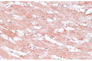 Immunohistochemistry of paraffin-embedded Rat heart using RPL30 Polyclonal Antibody at dilution of 1:100 (40x lens). (RPL30 anticorps)