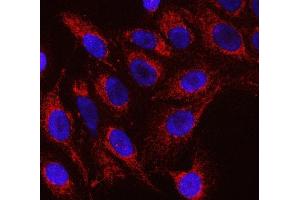 IF analysis of RFTN1 using anti-RFTN1 antibody (ABIN7600344). (RFTN1 anticorps  (AA 18-437))
