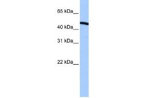 WB Suggested Anti-ZNF514 Antibody Titration:  0. (ZNF514 anticorps  (N-Term))