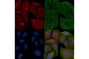 ABIN6258895 and ABIN6274392 staining Hela cells by IF/ICC. (FASTKD1 anticorps  (Internal Region))