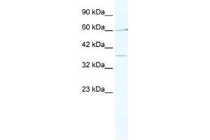 WB Suggested Anti-MTA1 Antibody Titration:  2. (MTA1 anticorps  (Middle Region))