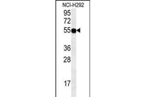 ZN Antibody (C-term) (ABIN654587 and ABIN2844288) western blot analysis in NCI- cell line lysates (35 μg/lane). (ZNF492 anticorps  (C-Term))