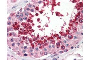 Immunohistochemistry (IHC) image for anti-Glutathione Peroxidase 4 (GPX4) (Middle Region) antibody (ABIN2787700)