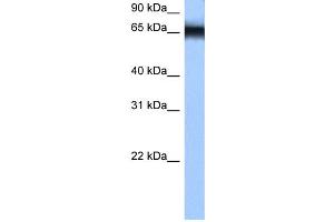 WB Suggested Anti-HNRPM Antibody Titration: 0. (HNRNPM anticorps  (N-Term))