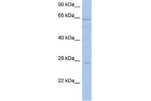 WB Suggested Anti-PRKAA1 Antibody Titration: 0. (PRKAA1 anticorps  (Middle Region))