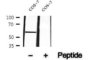 Western blot analysis of extracts of COS-7 cells, using Phospho-SGK3 (Thr320) Antibody .