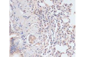 Immunohistochemistry of paraffin-embedded Rat lung using Phospho-STAT1(S727) Polyclonal Antibody at dilution of 1:100 (40x lens). (STAT1 anticorps  (pSer727))