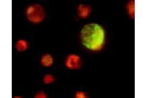 Immunofluorescence (IF) image for anti-Epstein-Barr Virus Viral Capsid Antigen gp110 (EBV VCA gp110) antibody (ABIN265548) (Epstein-Barr Virus Viral Capsid Antigen gp110 (EBV VCA gp110) anticorps)