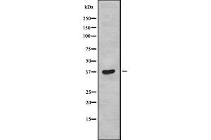 Western blot analysis of TAS2R38 using COLO205 whole cell lysates