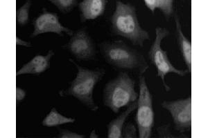 Immunofluorescent staining of HeLa (ATCC CCL-2) cells.