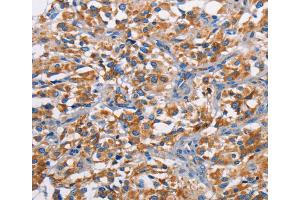 Immunohistochemistry (IHC) image for anti-Proto-Oncogene Pim-2 (Serine Threonine Kinase) (PIM2) antibody (ABIN2422823) (PIM2 anticorps)