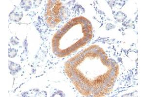 Image no. 1 for anti-CD86 (CD86) antibody (ABIN6185469) (CD86 anticorps)