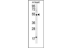 Western blot analysis of SCARA5 Antibody (C-term) Cat.