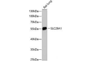 Western blot analysis of extracts of Rat lung using SLC29A1 Polyclonal Antibody at dilution of 1:3000. (SLC29A1 anticorps)