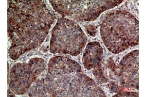 Immunohistochemistry (IHC) analysis of paraffin-embedded Human Lung, antibody was diluted at 1:100. (IL-24 anticorps  (Internal Region))