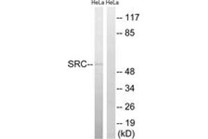 Western blot analysis of extracts from HeLa cells, treated with Hu 2nM 24h, using Src (Ab-75) Antibody. (Src anticorps  (AA 41-90))