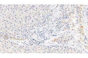 anti-C-Reactive Protein (CRP) (AA 17-224) antibody