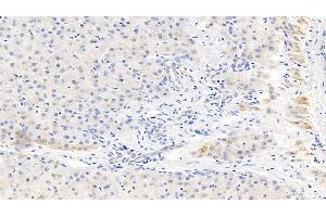 Detection of CRP in Human Liver Tissue using Monoclonal Antibody to C Reactive Protein (CRP) (CRP anticorps  (AA 17-224))