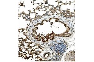 IHC analysis of Caveolin-2 using anti-Caveolin-2 antibody (ABIN3043749).