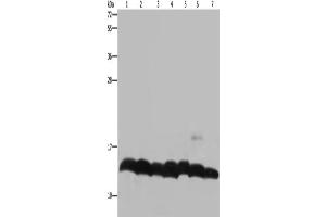Western Blotting (WB) image for anti-Histone H4 antibody (ABIN2423581) (Histone H4 anticorps)