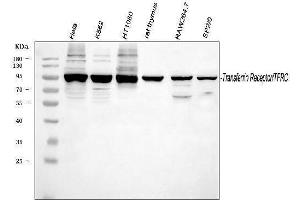 Western blot analysis of TFRC using anti-TFRC antibody (ABIN3043538). (Transferrin Receptor anticorps  (AA 1-198))