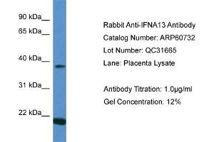 Western Blotting (WB) image for anti-Interferon, alpha 13 (IFNA13) (C-Term) antibody (ABIN2788553)