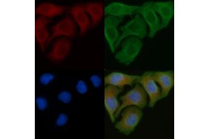 ABIN6265505 and ABIN6276977 staining Hela cells by IF/ICC.