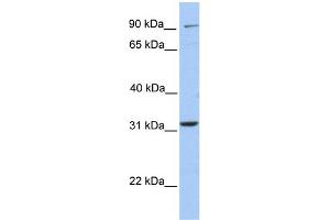 WB Suggested Anti-ELFN2 Antibody Titration:  0. (ELFN2 anticorps  (N-Term))